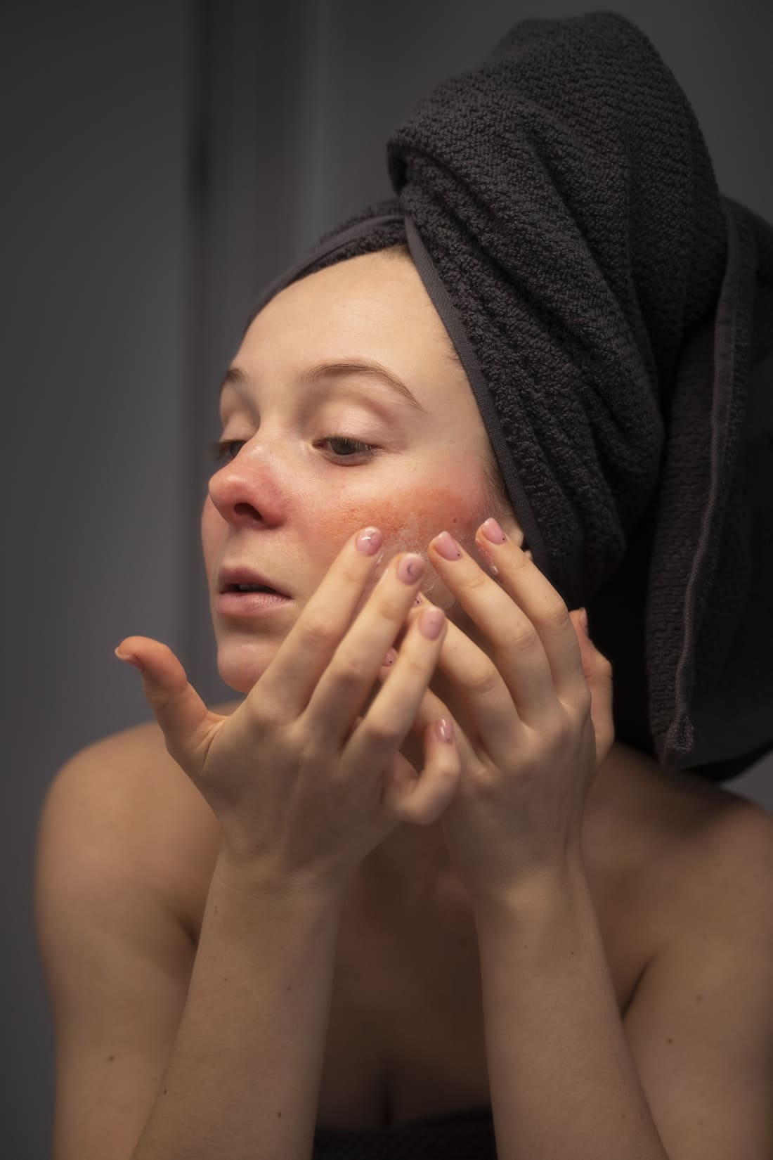 Femme regardant sa rougeur pour peau sèche au visage